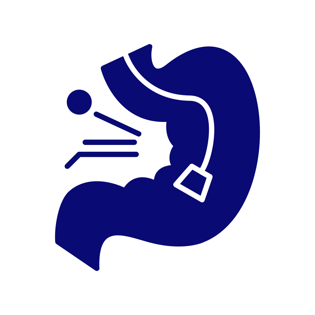 위내시경