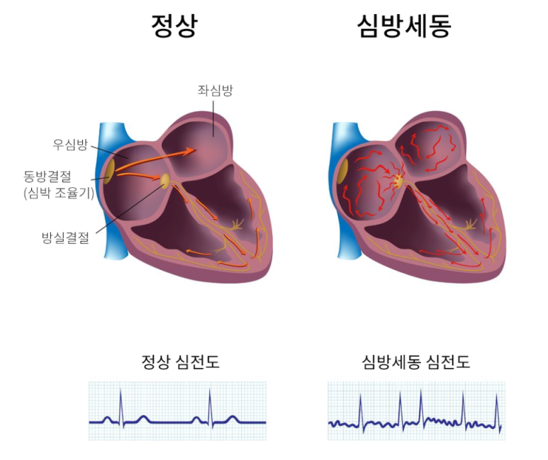 두근거림 검사방법