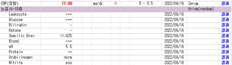 복부CT: 좌측 신장 염증 소견