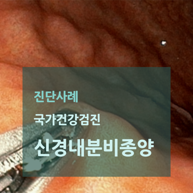 위내시경: 다발성으로 융기된 병변