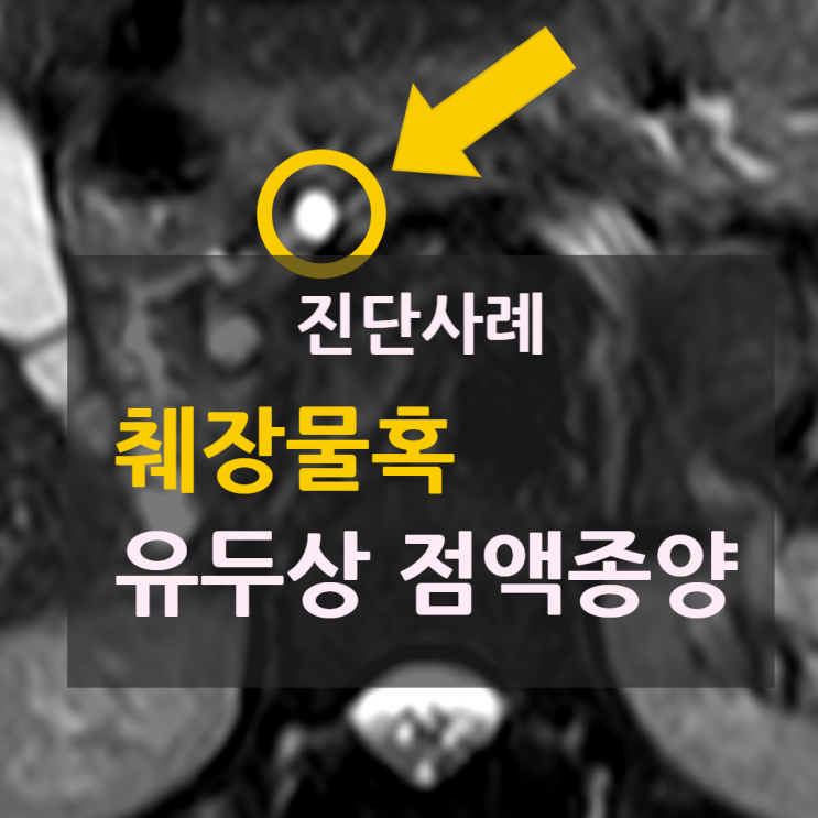 건강검진 후 발견된 췌장물혹 → 췌관내 유두상 점액 종양