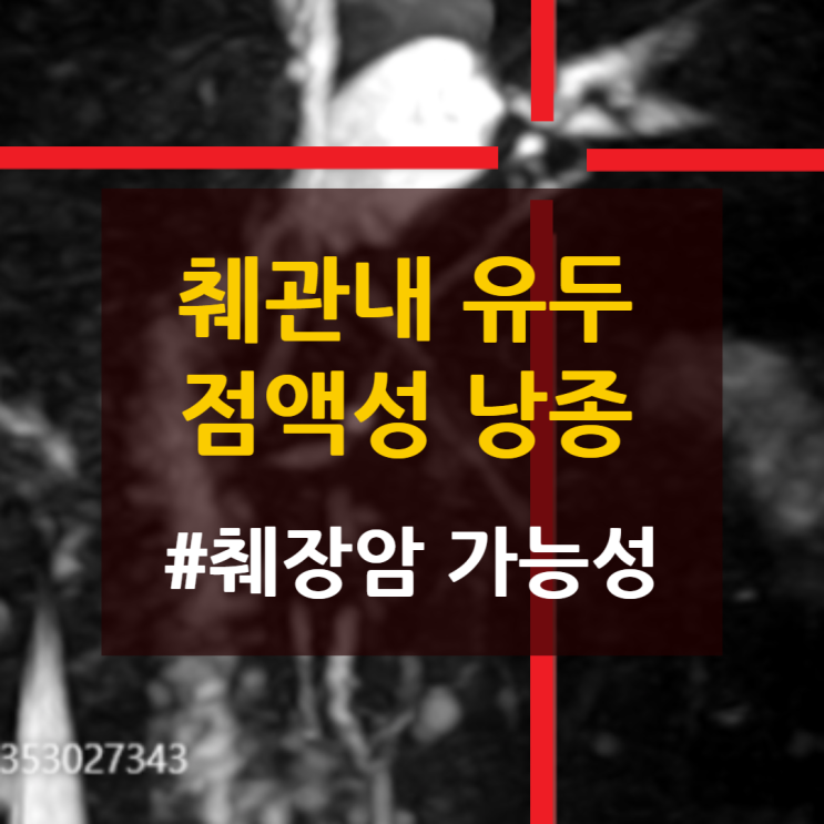 무증상·건강검진 — 췌장MRI에서 확인된 췌관내 유두 점액성 낭종 #검사방법