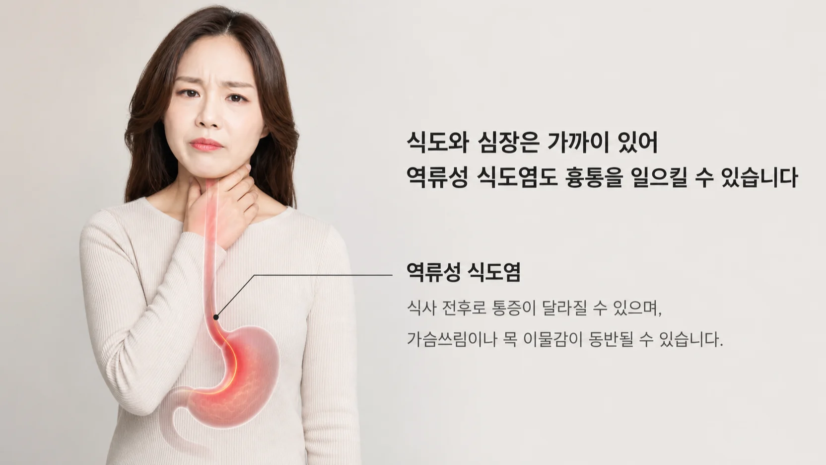 식도와 심장이 인접해 있어 역류성 식도염일 때도 흉통이 생길 수 있음을 보여 주는 그림