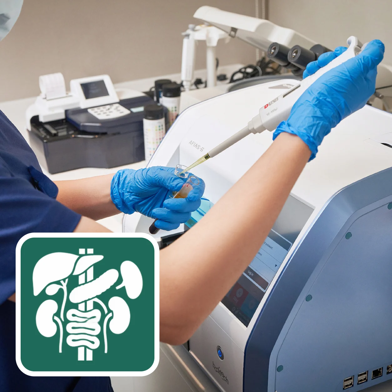 복통 관련 혈액검사 (Abdominal Pain Blood Tests) 검사 안내