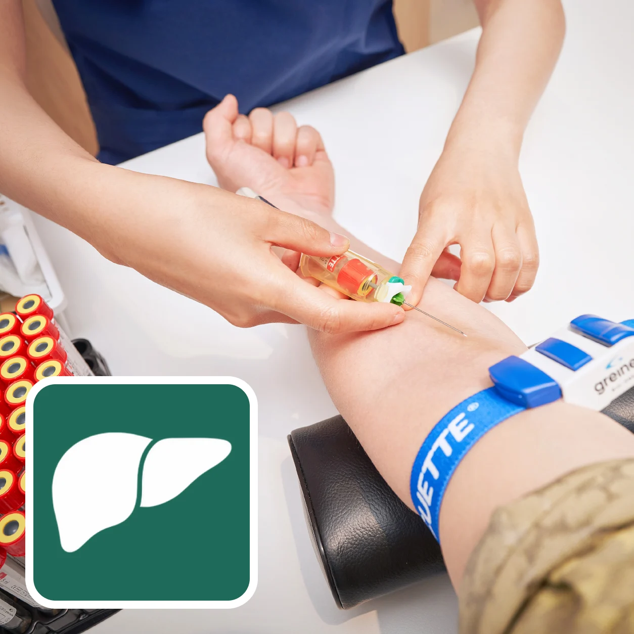 간기능 혈액검사 (Liver Function Tests) 검사 안내