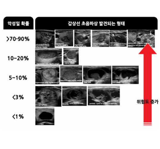 갑상선 초음파 (Thyroid Ultrasound) | 분당 판교 영상의학과가 있는 내과 & 검진센터ㅣ지앤이 알파돔 메디컬센터