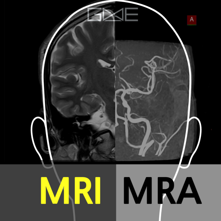 뇌MRI (Brain MRI) | 분당 판교 영상의학과가 있는 내과 & 검진센터ㅣ지앤이 알파돔 메디컬센터